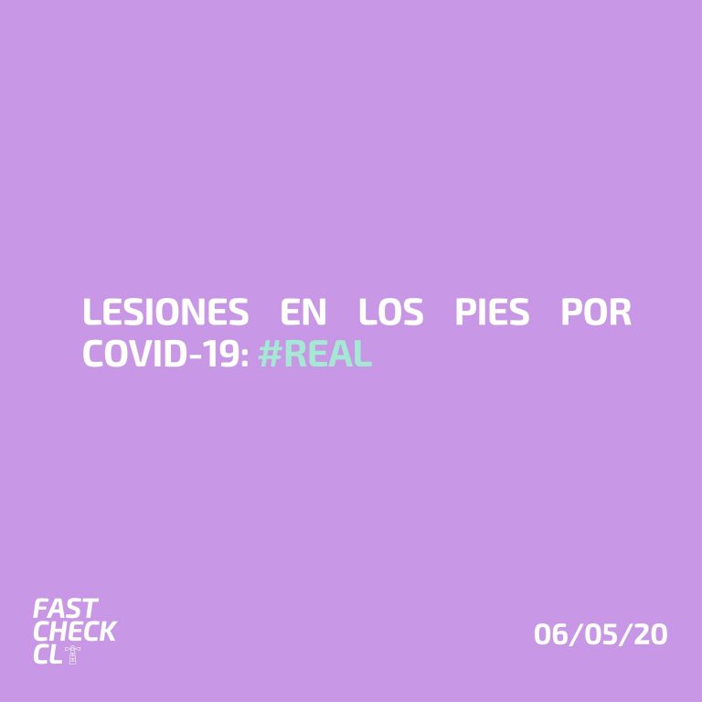 Read more about the article Lesiones en los pies por Covid-19: #Real