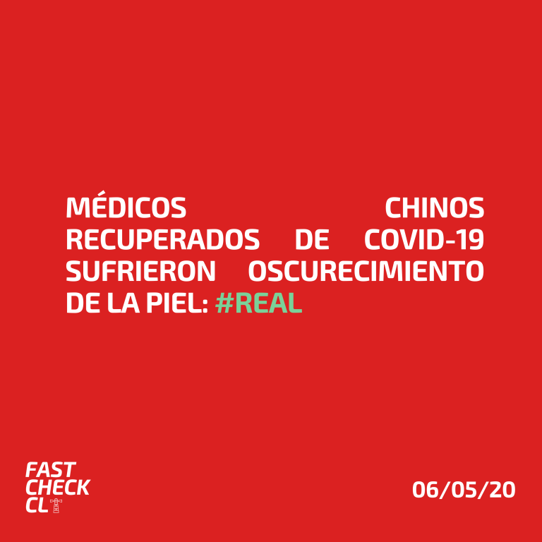 Lee más sobre el artículo Médicos chinos recuperados de Covid-19 sufrieron oscurecimiento de la piel: #Real