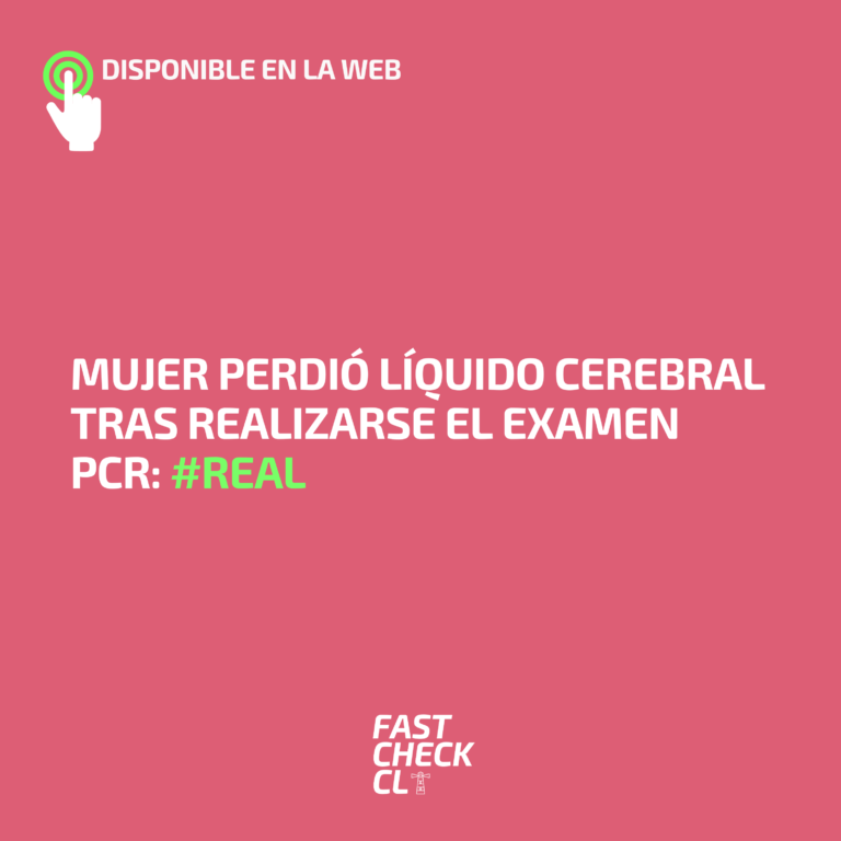 Read more about the article Mujer perdió líquido cerebral tras realizarse el examen PCR: #Real