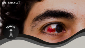 Read more about the article Programa Integral de Reparaci贸n Ocular: las falencias del programa de Salud para atender v铆ctimas de estallidos oculares