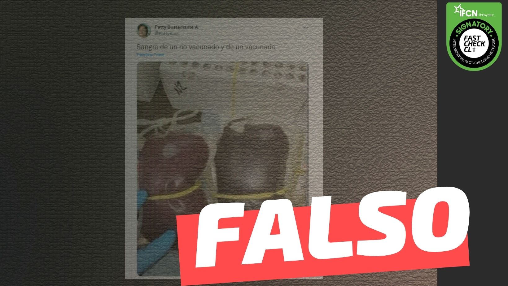 You are currently viewing (Imagen) La sangre cambia de color cuando te vacunas: #Falso