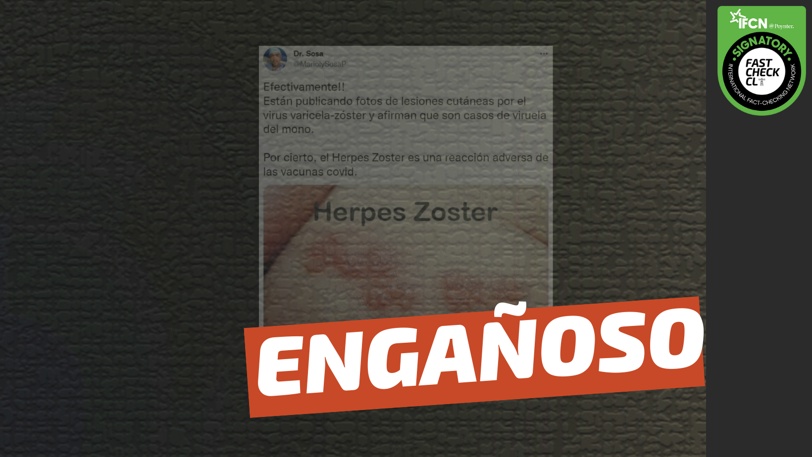 You are currently viewing “Están publicando fotos de lesiones cutáneas por el virus varicela-zóster y afirman que es la viruela del mono. Por cierto el Herpes Zóster es una reacción adversa de las vacunas Covid-19”: #Engañoso