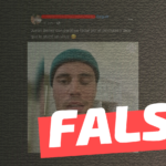 Justin Bieber sufre parálisis facial por vacunarse contra el Covid-19: #Falso