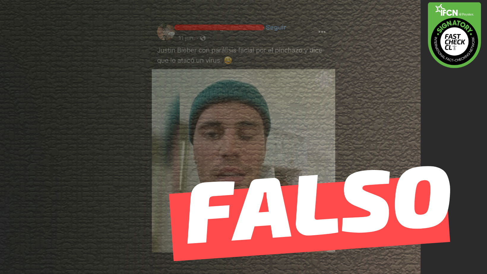 You are currently viewing Justin Bieber sufre parálisis facial por vacunarse contra el Covid-19: #Falso
