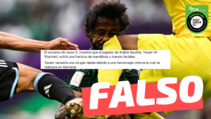 Read more about the article (Imagen) “El escaneo de rayos X muestra que el jugador de Arabia Saudita, Yasser Al-Shahrani, sufrió una fractura de mandíbula y huesos faciales”: #Falso￼
