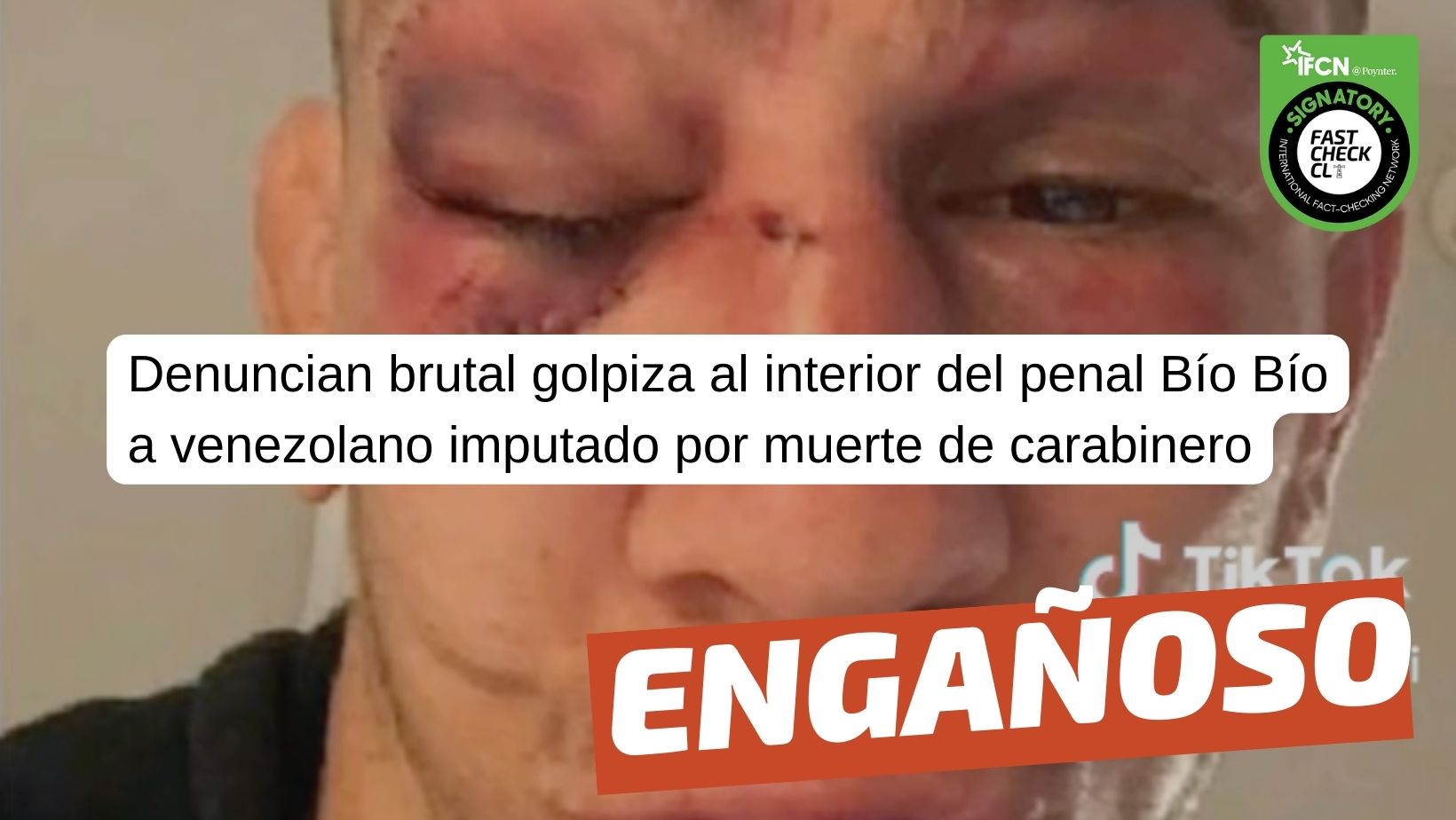 You are currently viewing (Imagen) “Denuncian brutal golpiza al interior del penal Bío Bío a venezolano imputado por muerte de Carabinero”: #Engañoso