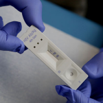 Chile Positivo: “Es imposible que el VIH se transmita a través de un beso”