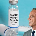 Muere primer niño por sarampión en una década en Estados Unidos: actual secretario de Salud (Kennedy) en 2021 negó mortalidad de la enfermedad 