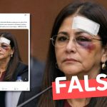 (Imagen) “Cilia Flores, esposa de Nicolás Maduro, aparece en esta foto seriamente golpeada”: #Falso